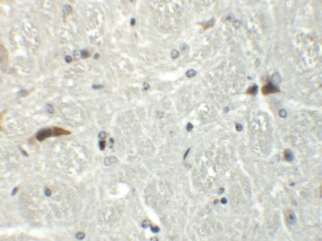 Rabex-5 Antibody in Immunohistochemistry (IHC)