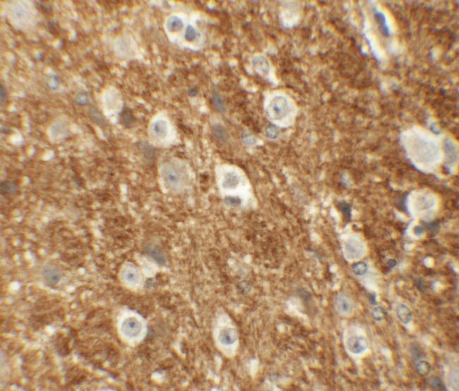 ROCK2 Antibody in Immunohistochemistry (IHC)