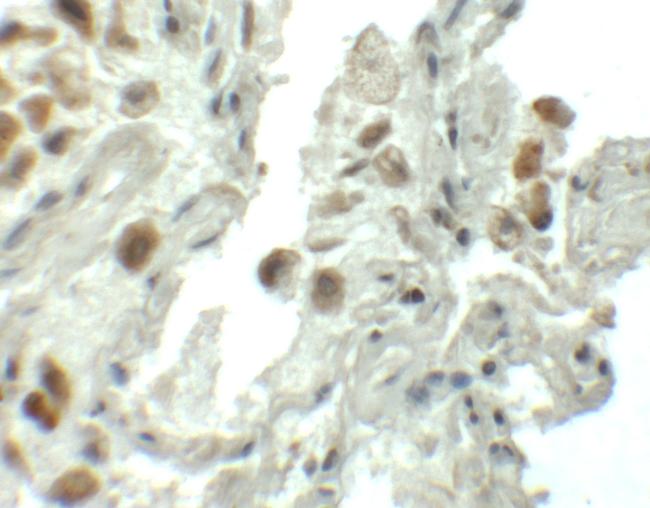 SPTLC1 Antibody in Immunohistochemistry (IHC)