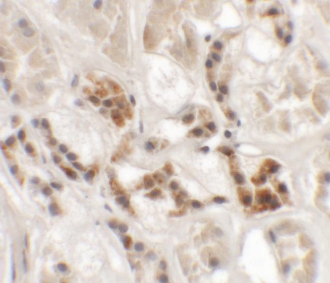 AP3S1 Antibody in Immunohistochemistry (IHC)