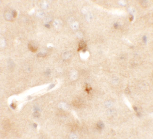 CCDC141 Antibody in Immunohistochemistry (IHC)