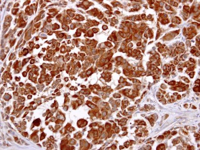 LHR Antibody in Immunohistochemistry (Paraffin) (IHC (P))