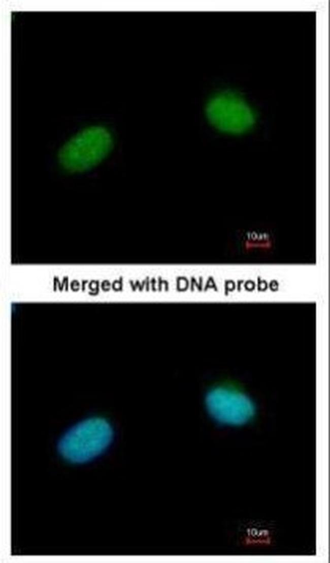 XRCC3 Antibody in Immunocytochemistry (ICC/IF)