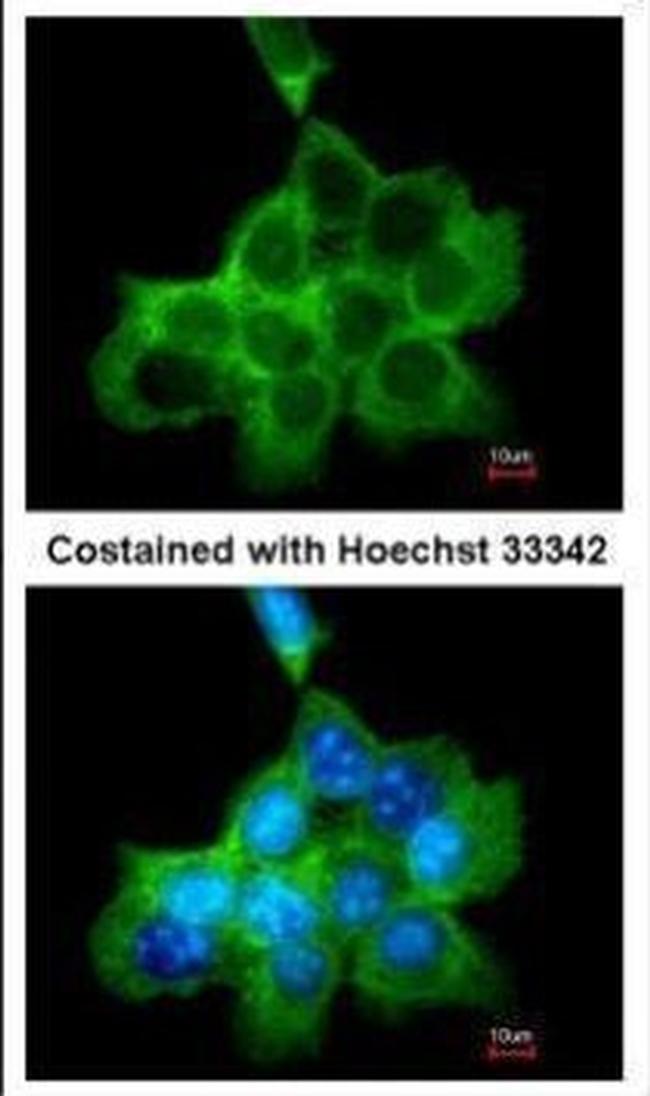 DOCK1 Antibody in Immunocytochemistry (ICC/IF)