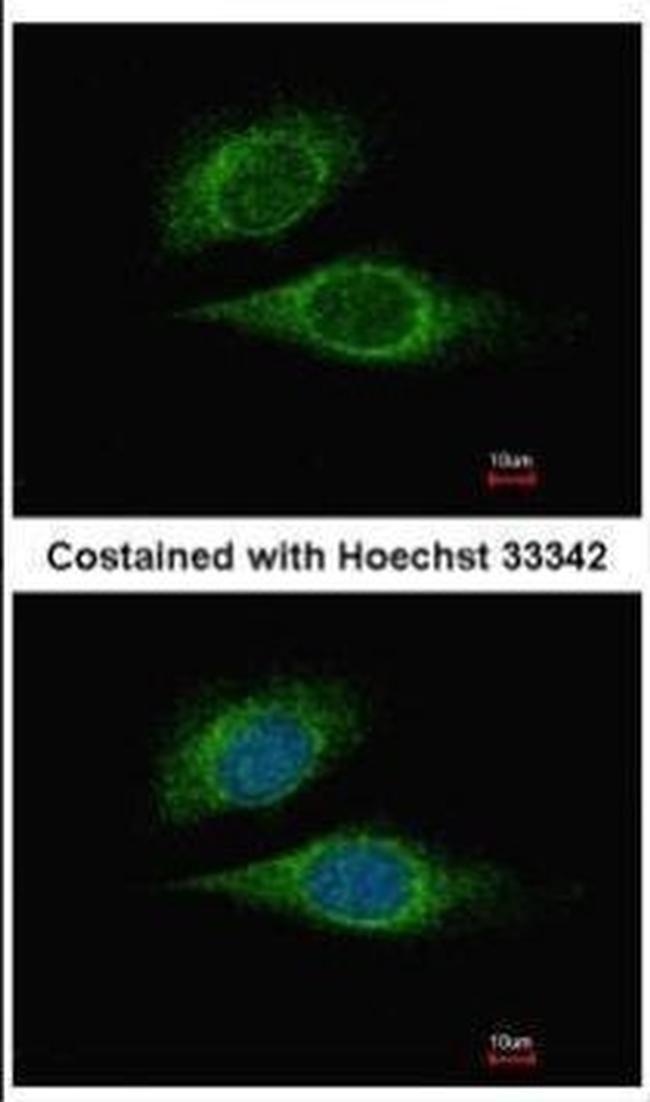 ELF3 Antibody in Immunocytochemistry (ICC/IF)