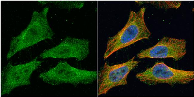 EML1 Antibody in Immunocytochemistry (ICC/IF)