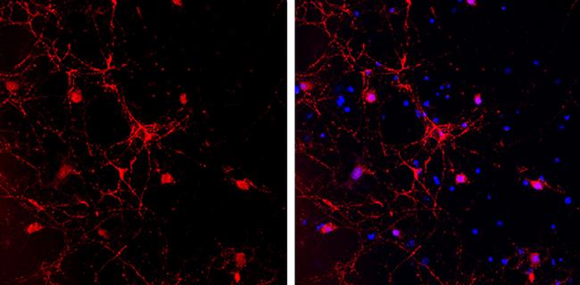 GAD65 Antibody in Immunocytochemistry (ICC/IF)