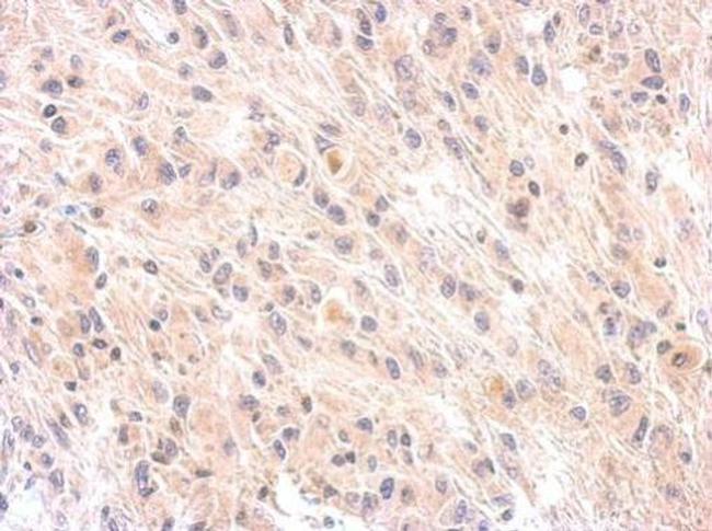 Complement Factor H Antibody in Immunohistochemistry (Paraffin) (IHC (P))