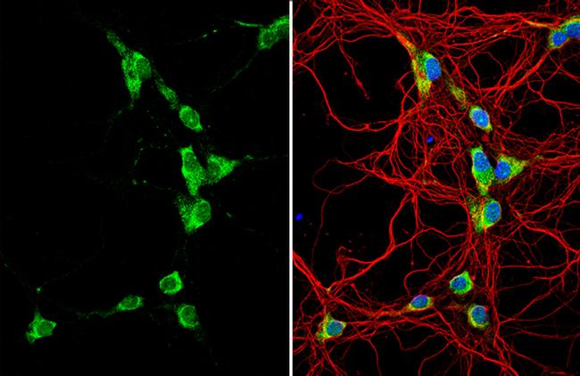 GALR2 Antibody in Immunocytochemistry (ICC/IF)