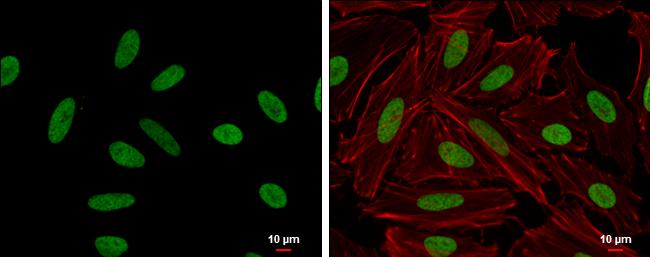 HMGA2 Antibody in Immunocytochemistry (ICC/IF)