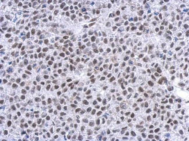 Glucocorticoid Receptor Antibody in Immunohistochemistry (Paraffin) (IHC (P))