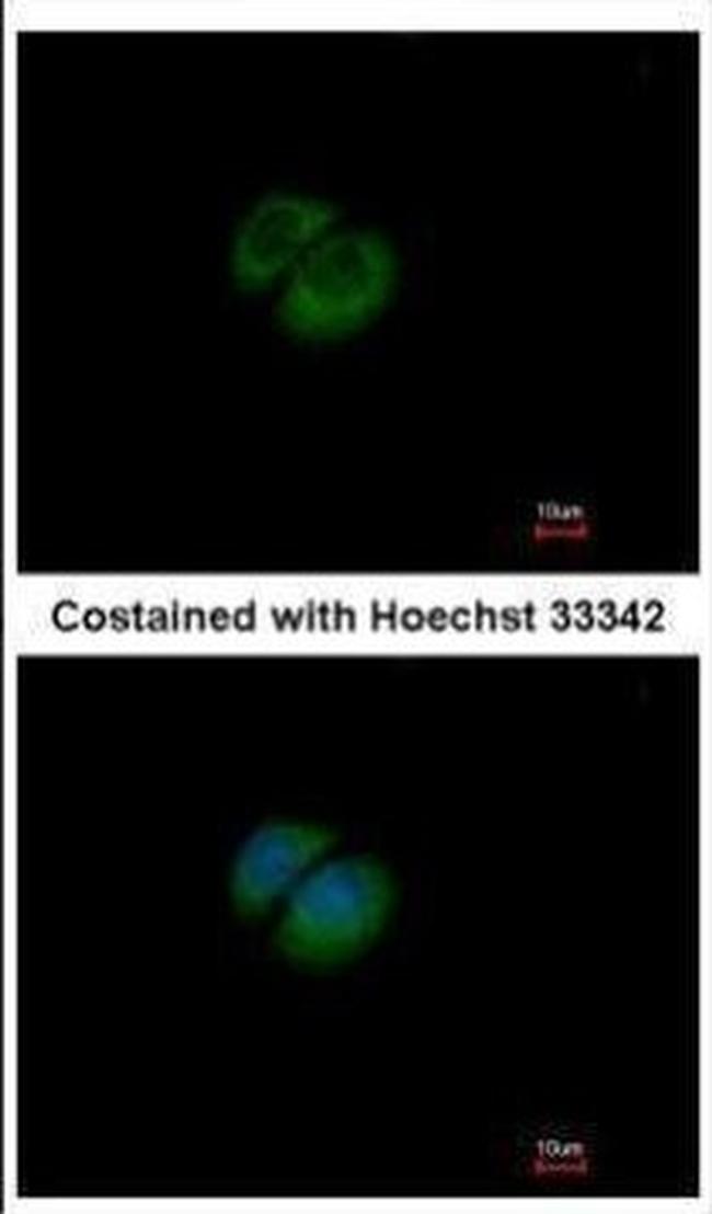 HPRT1 Antibody in Immunocytochemistry (ICC/IF)