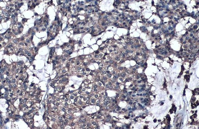 GGT1 Antibody in Immunohistochemistry (Paraffin) (IHC (P))