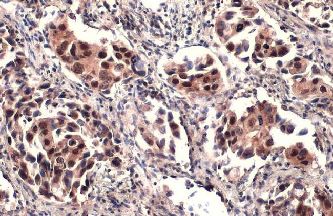 ATRX Antibody in Immunohistochemistry (Paraffin) (IHC (P))