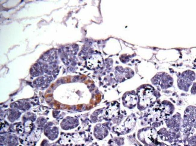 CAD Antibody in Immunohistochemistry (Paraffin) (IHC (P))