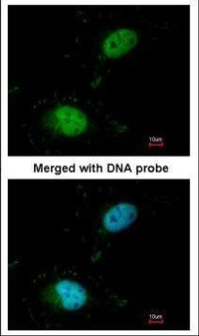 SAFB Antibody in Immunocytochemistry (ICC/IF)