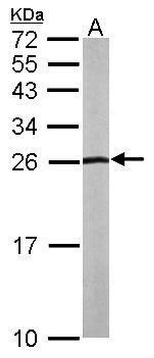 NHERF2 Antibody in Western Blot (WB)