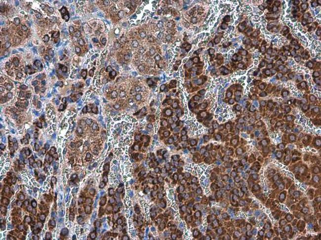 ODC1 Antibody in Immunohistochemistry (Paraffin) (IHC (P))