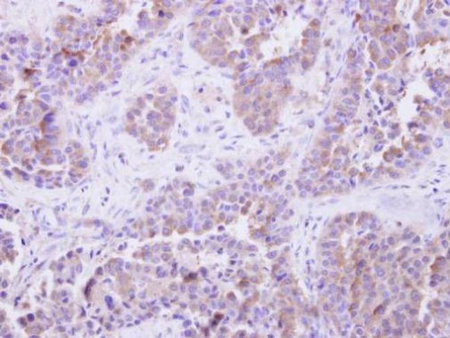 SGTA Antibody in Immunohistochemistry (Paraffin) (IHC (P))