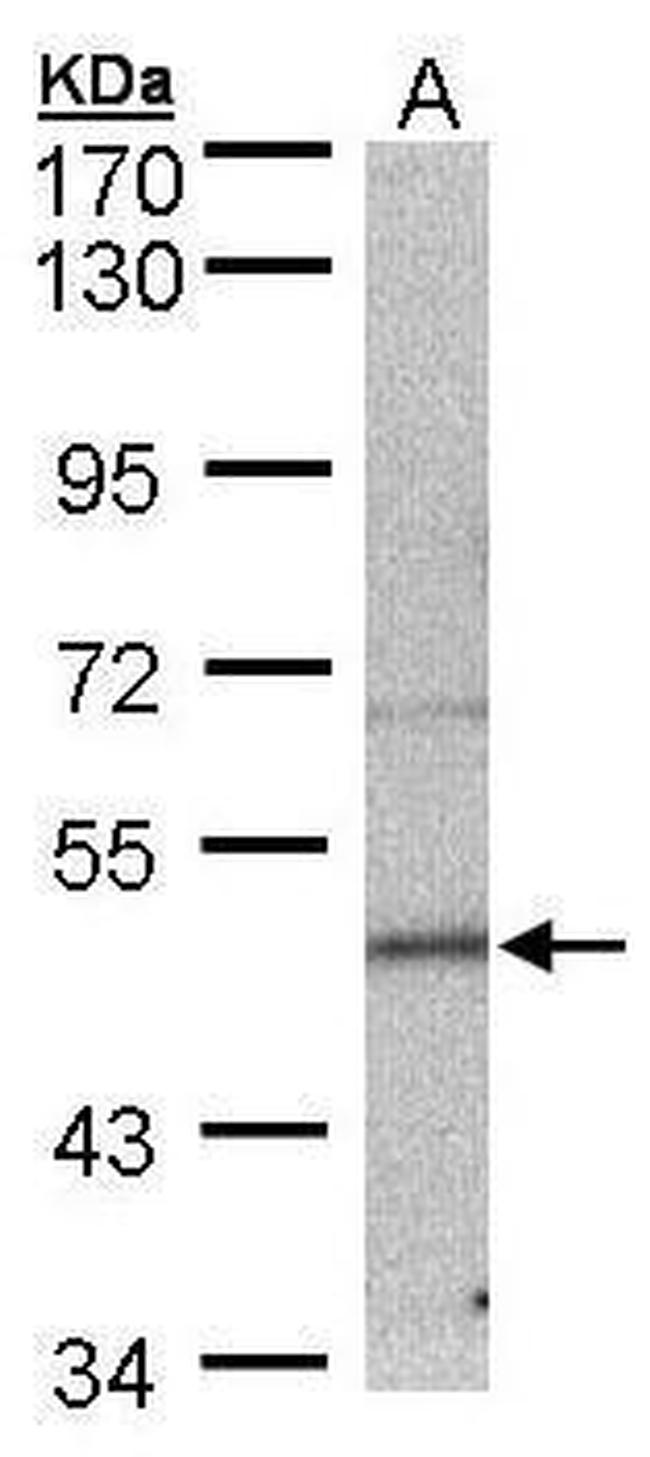 Septin-7 Antibody in Western Blot (WB)