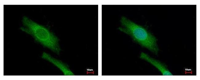 DAP5 Antibody in Immunocytochemistry (ICC/IF)