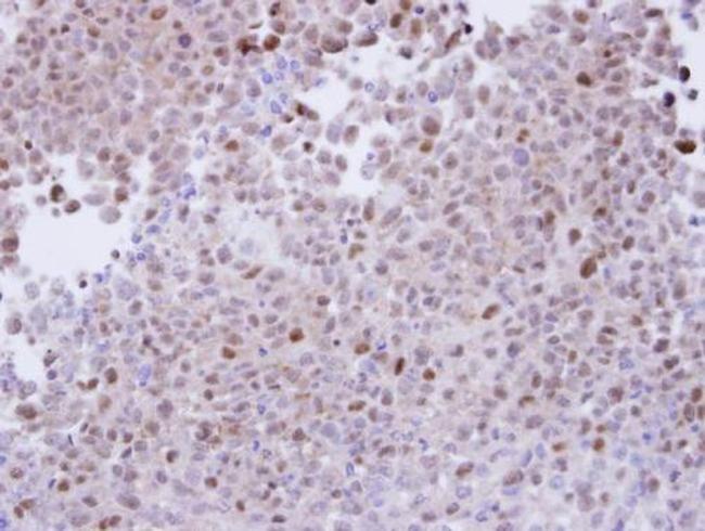 PSMA7 Antibody in Immunohistochemistry (Paraffin) (IHC (P))