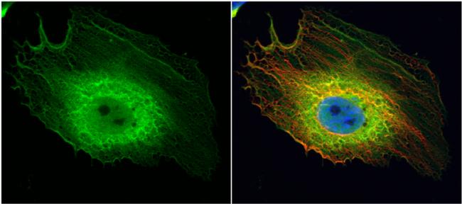 ENO1 Antibody in Immunocytochemistry (ICC/IF)