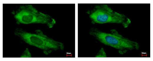 RPS10 Antibody in Immunocytochemistry (ICC/IF)