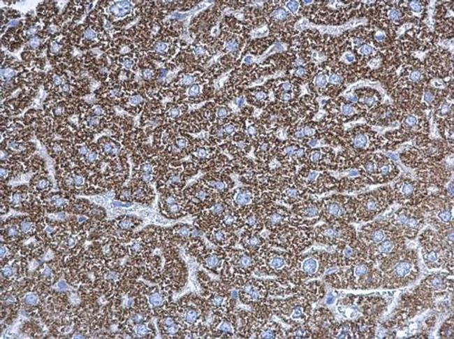 UQCRC1 Antibody in Immunohistochemistry (Paraffin) (IHC (P))