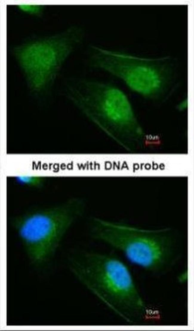 DNAJB6 Antibody in Immunocytochemistry (ICC/IF)