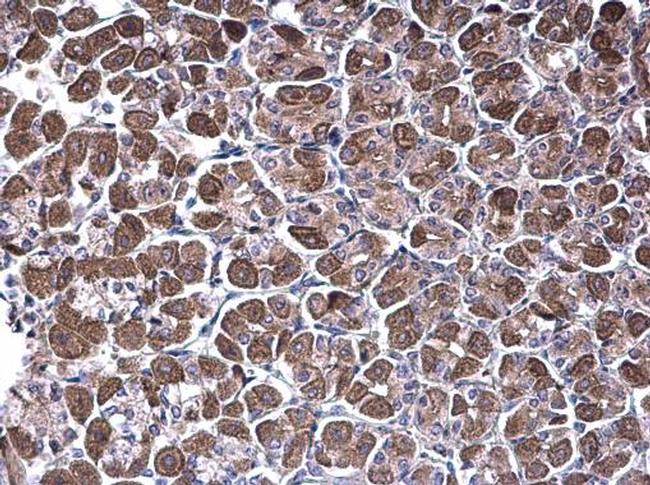 NDUFV1 Antibody in Immunohistochemistry (Paraffin) (IHC (P))