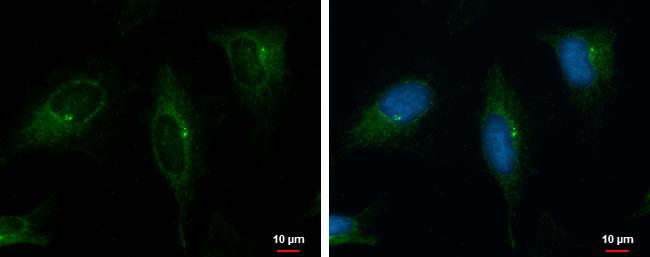 PRKD2 Antibody in Immunocytochemistry (ICC/IF)