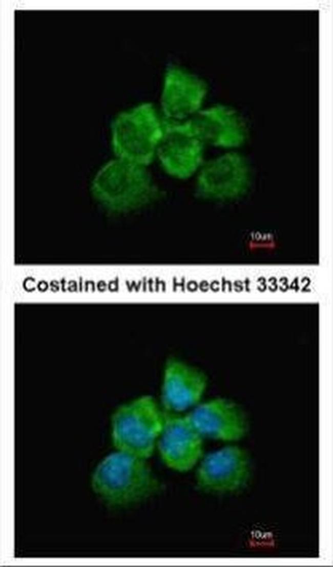 ARHGEF18 Antibody in Immunocytochemistry (ICC/IF)