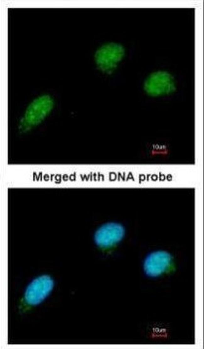 CtBP2 Antibody in Immunocytochemistry (ICC/IF)