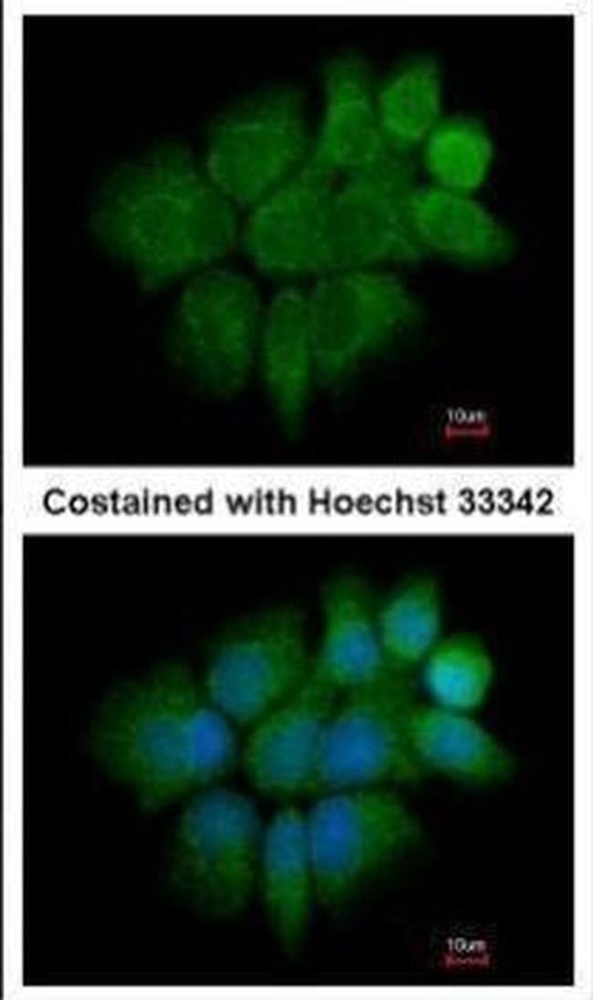 Cytokeratin 2e Antibody in Immunocytochemistry (ICC/IF)