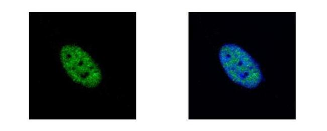 NEK4 Antibody in Immunocytochemistry (ICC/IF)