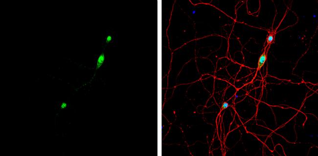 NOVA1 Antibody in Immunocytochemistry (ICC/IF)