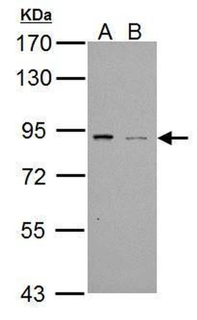 PDE4B Antibody in Western Blot (WB)