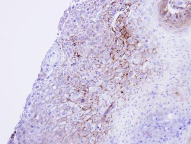 CaV1.1 Antibody in Immunohistochemistry (Paraffin) (IHC (P))