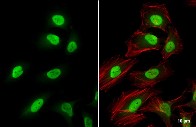 CAS Antibody in Immunocytochemistry (ICC/IF)