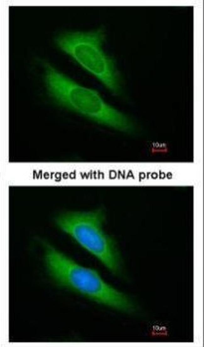 ATIC Antibody in Immunocytochemistry (ICC/IF)