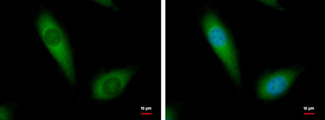 NDUFA10 Antibody in Immunocytochemistry (ICC/IF)