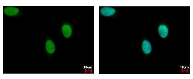 DNA Ligase III Antibody in Immunocytochemistry (ICC/IF)