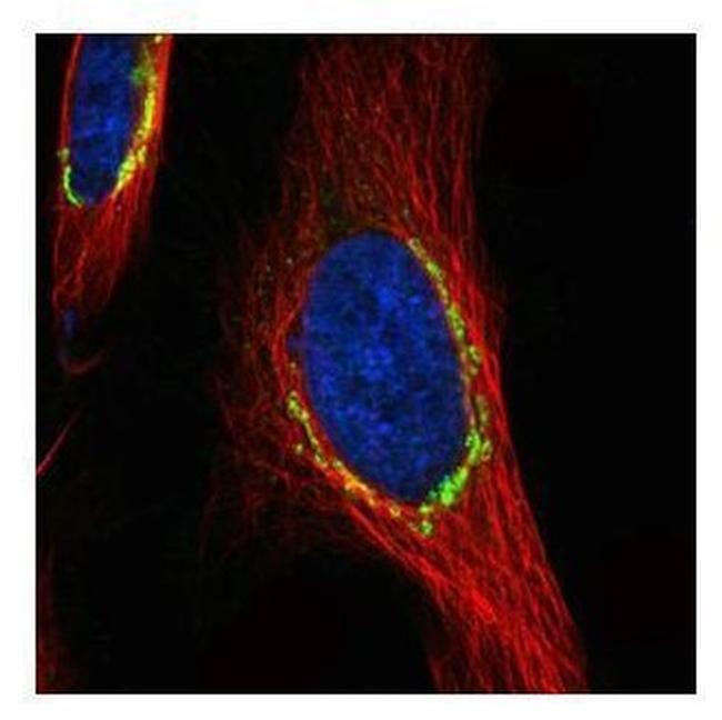 COPD Antibody in Immunocytochemistry (ICC/IF)