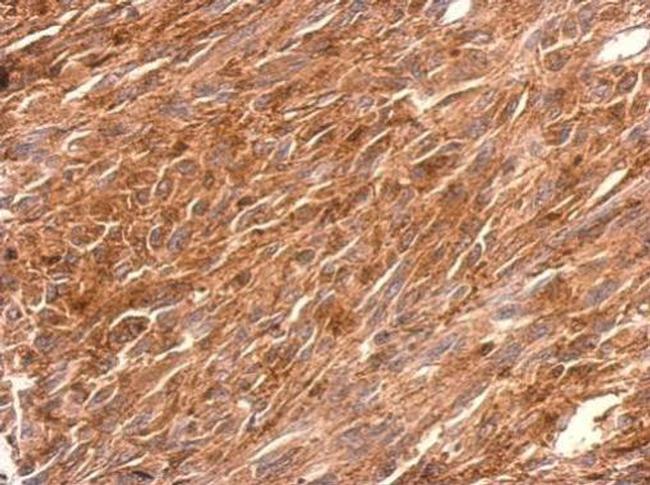 PGCP Antibody in Immunohistochemistry (Paraffin) (IHC (P))