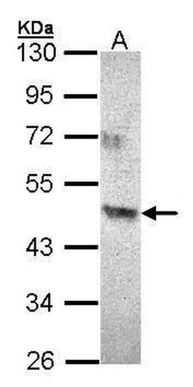 ACAD8 Antibody in Western Blot (WB)