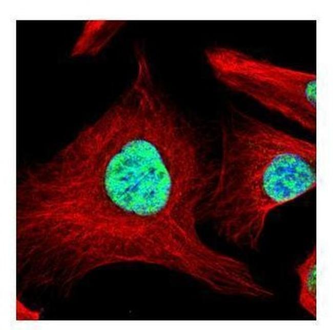 SART1 Antibody in Immunocytochemistry (ICC/IF)