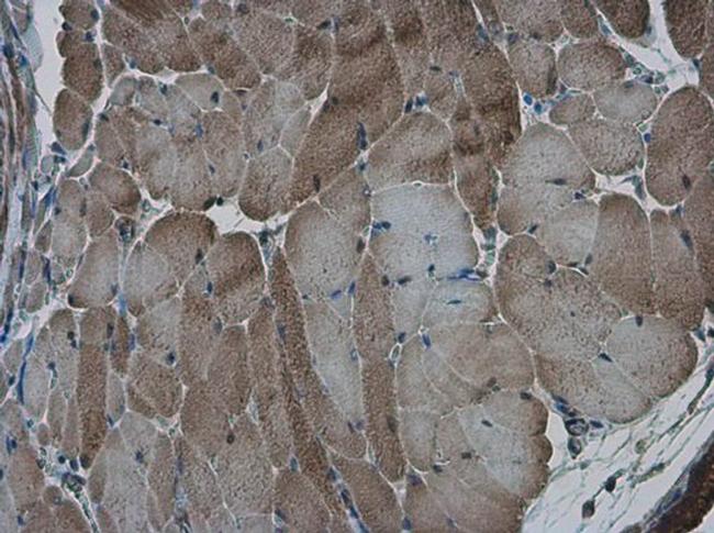 AMPK alpha-2 Antibody in Immunohistochemistry (Paraffin) (IHC (P))