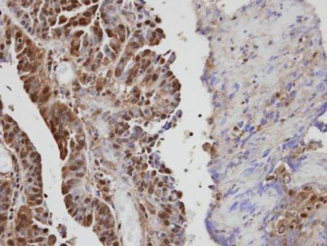 VAV1 Antibody in Immunohistochemistry (Paraffin) (IHC (P))