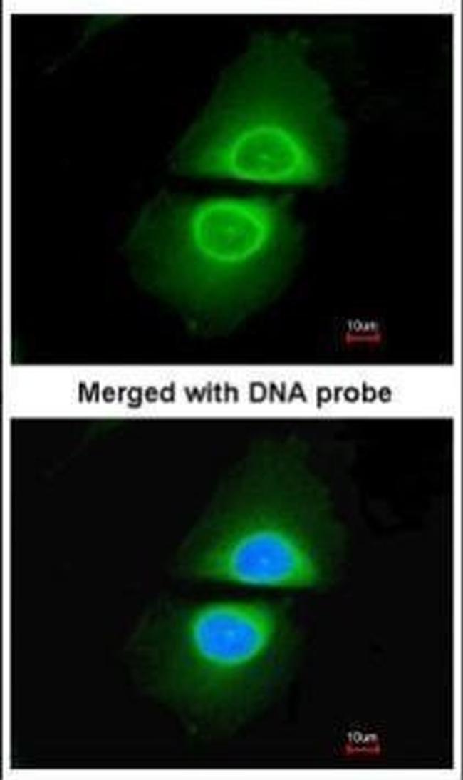 CYP4A11 Antibody in Immunocytochemistry (ICC/IF)